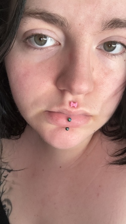 Fundraising Page Image